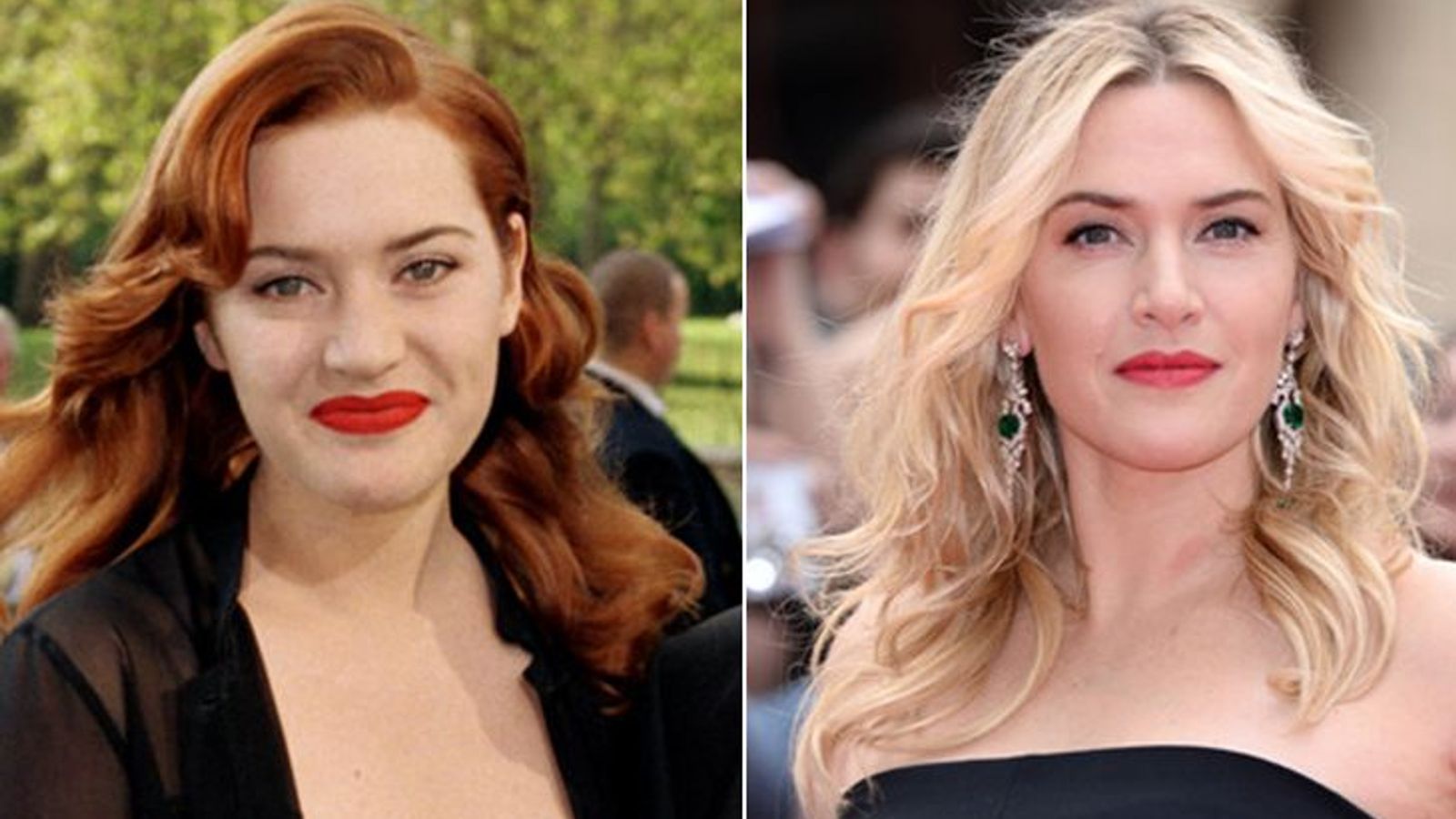 Kate Winslet before and after plasty