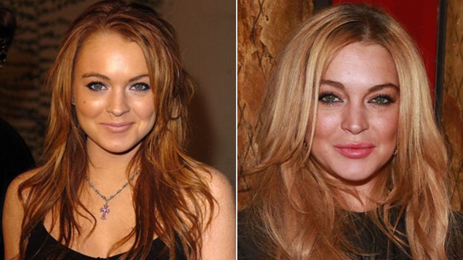 Lindsay Lohan before and after plastic surgery.