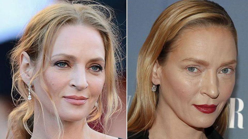 Uma Thurman before and after unsuccessful plastics