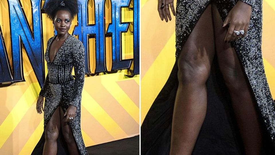 Thick Legs Of Lupita Nyong`o